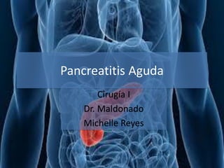 Pancreatitis Aguda
Cirugía I
Dr. Maldonado
Michelle Reyes
 
