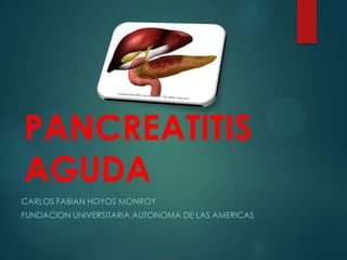 PANCREATITIS
AGUDA
CARLOS FABIAN HOYOS MONROY
FUNDACION UNIVERSITARIA AUTONOMA DE LAS AMERICAS
 