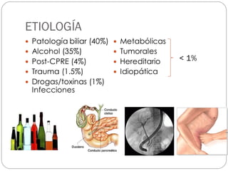 ETIOLOGÍA 
< 1% 
 