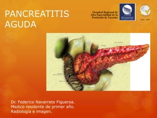 PANCREATITIS
AGUDA
Dr. Federico Navarrete Figueroa.
Medico residente de primer año.
Radiología e imagen.
 
