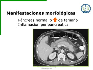 Manifestaciones morfológicas
Páncreas normal o de tamaño
Inflamación peripancreática
Balthazar EJ et al. Imaging and Intervention
in acute pancreatitis. Radiology
1994;193:297-306
 