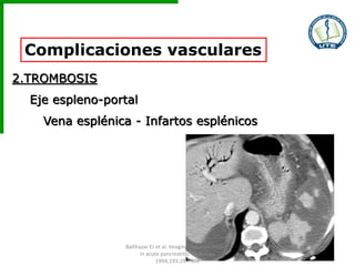 Complicaciones vasculares
2.TROMBOSIS
Eje espleno-portal
Vena esplénica - Infartos esplénicos
Balthazar EJ et al. Imaging and Intervention
in acute pancreatitis. Radiology
1994;193:297-306
 