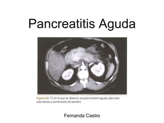 Pancreatitis Aguda
Fernanda Castro
 