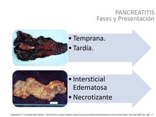PANCREATITIS
Fagenholz PJ , Fernandez-del Castillo C , Harris NS et al. Direct medical costs of acute pancreatitis hospitalizations in the United States. Pancreas 2007; 35 : 302 – 7.
•Temprana.
•Tardía.
•Intersticial
Edematosa
•Necrotizante
Fases y Presentación
 