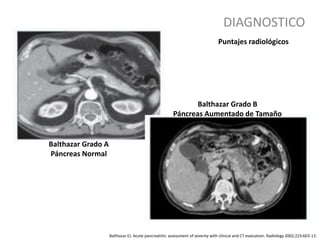 DIAGNOSTICO
Balthazar EJ. Acute pancreatitis: assessment of severity with clinical and CT evaluation. Radiology 2002;223:603-13.
Puntajes radiológicos
Balthazar Grado A
Páncreas Normal
Balthazar Grado B
Páncreas Aumentado de Tamaño
 