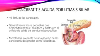 PANCREATITIS AGUDA POR LITIASIS BILIAR
• 40-50% de las pancreatitis
• Generalmente litiasis pequeñas que
descienden hasta el colédoco y obstruyen el
orificio de salida del conducto pancreático.
• Microlitiasis, causante de una porción de las
pancreatitis designadas como idiopáticas.
 