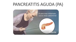 PANCREATITIS AGUDA (PA)
 