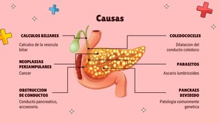 pancreatitis aguda.pptx