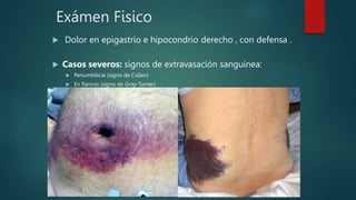 Exámen Fisico
 Dolor en epigastrio e hipocondrio derecho , con defensa .
 Casos severos: signos de extravasación sanguínea:
 Periumbilical (signo de Cüllen)
 En flancos (signo de Gray-Turner)
 