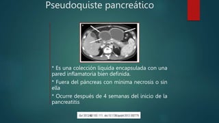 Pseudoquiste pancreático
* Es una colección líquida encapsulada con una
pared inflamatoria bien definida.
* Fuera del páncreas con mínima necrosis o sin
ella
* Ocurre después de 4 semanas del inicio de la
pancreatitis
 