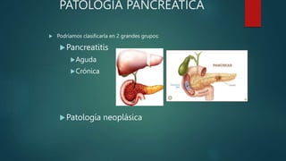 PATOLOGÍA PANCREÁTICA
 Podríamos clasificarla en 2 grandes grupos:
Pancreatitis
Aguda
Crónica
Patología neoplásica
 