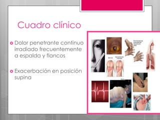 Cuadro clínico
 Dolor

penetrante continuo
irradiado frecuentemente
a espalda y flancos

 Exacerbación

supina

en posición

 