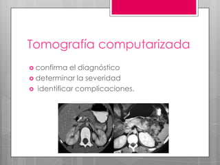 Tomografía computarizada
 confirma

el diagnóstico
 determinar la severidad
 identificar complicaciones.

 