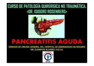 SERVICIO DE CIRUGÍA GENERAL DEL HOSPITAL DE EMERGENCIAS DE ROSARIO
DR. CLEMENTE ÁLVAREZ. H.E.C.A.
CURSO DE PATOLOGÍA QUIRÚRGICA NO TRAUMÁTICA.
<DR. ISIDORO ROSENBERG>
PANCREATITIS AGUDA
 