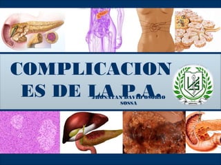 COMPLICACION
ES DE LA P.A.JHONATAN DAVID OSORIO
SOSSA
 