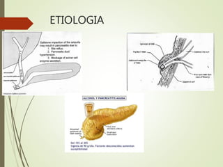ETIOLOGIA
 