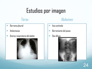 Estudios por imagen
Tórax

Abdomen

 Derrame pleural

 Asa centinela

 Atelectasias

 Borramiento del psoas

 Distres respiratorio del adulto

 Íleo difuso

24

 