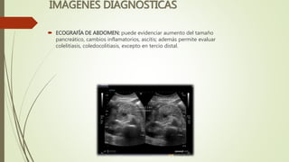 IMÁGENES DIAGNOSTICAS
 ECOGRAFÍA DE ABDOMEN: puede evidenciar aumento del tamaño
pancreático, cambios inflamatorios, ascitis; además permite evaluar
colelitiasis, coledocolitiasis, excepto en tercio distal.
 