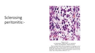 Sclerosing
peritonitis:-
 