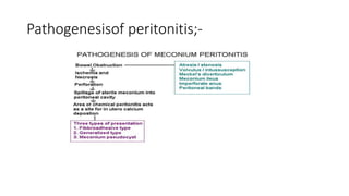 Pathogenesisof peritonitis;-
 