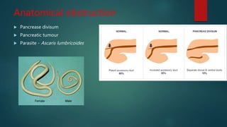 Anatomical obstruction
 Pancrease divisum
 Pancreatic tumour
 Parasite - Ascaris lumbricoides
 