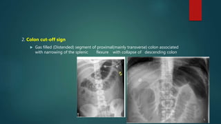 2. Colon cut-off sign
 Gas filled (Distended) segment of proximal(mainly transverse) colon associated
with narrowing of the splenic flexure with collapse of descending colon
 