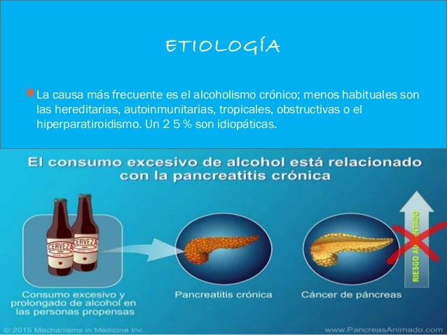 Pancreatitis cronica Pancreatitis cronica