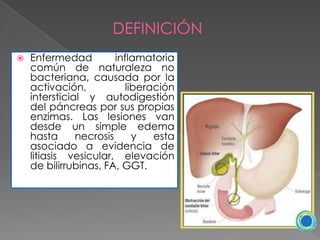 DEFINICIÓN


Enfermedad
inflamatoria
común de naturaleza no
bacteriana, causada por la
activación,
liberación
intersticial y autodigestión
del páncreas por sus propias
enzimas. Las lesiones van
desde un simple edema
hasta
necrosis
y
esta
asociado a evidencia de
litiasis vesicular, elevación
de bilirrubinas, FA, GGT.

 