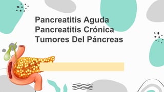 Pancreatitis Aguda
Pancreatitis Crónica
Tumores Del Páncreas
 