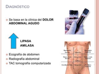 DIAGNÓSTICO
 Se basa en la clínica del DOLOR
ABDOMINAL AGUDO
LIPASA
AMILASA
 Ecografía de abdomen
 Radiografía abdominal
 TAC tomografía computarizada
 