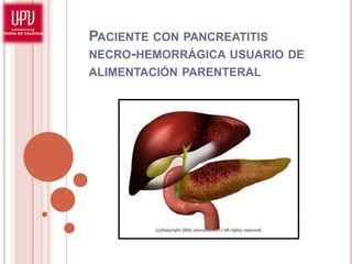 PACIENTE CON PANCREATITIS
NECRO-HEMORRÁGICA USUARIO DE
ALIMENTACIÓN PARENTERAL
 