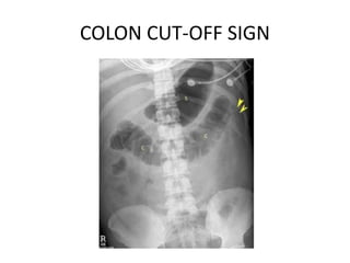 COLON CUT-OFF SIGN
 