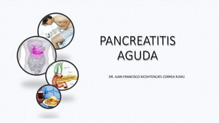 PANCREATITIS
AGUDA
DR. JUAN FRANCISCO XICOHTENCATL CORREA R1MU
 