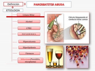 Definición

ETIOLOGIA
               Litiasis Biliar


                  Alcohol


                   CPRE

              POST QUIRURGICA



                Hipercalcemia

               Hiperlipidemia

                   Fármacos

             Infecciosas(Parotiditis,
                  micoplasma)
 