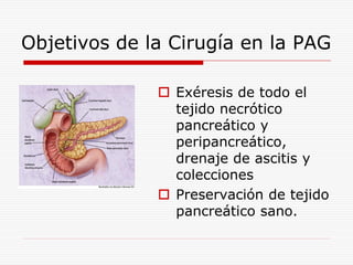 Objetivos de la Cirugía en la PAG

               Exéresis de todo el
                tejido necrótico
                pancreático y
                peripancreático,
                drenaje de ascitis y
                colecciones
               Preservación de tejido
                pancreático sano.
 