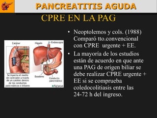 CPRE EN LA PAG Neoptolemos y cols. (1988) Comparó tto.convencional con CPRE  urgente + EE.  La mayoría de los estudios están de acuerdo en que ante una PAG de origen biliar se debe realizar CPRE urgente + EE si se comprueba coledocolitiasis entre las 24-72 h del ingreso. PANCREATITIS AGUDA 