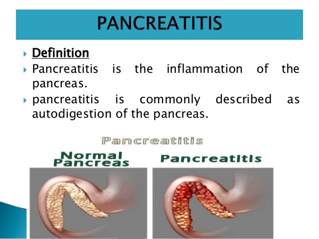 Acute And Chronic Pancreatitis