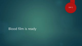 Blood film is ready
DAY 2
 