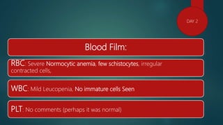 Blood Film:
RBC: Severe Normocytic anemia, few schistocytes, irregular
contracted cells,
WBC: Mild Leucopenia, No immature cells Seen
PLT: No comments (perhaps it was normal)
DAY 2
 