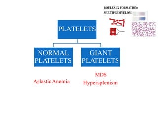 PLATELETS
NORMAL
PLATELETS
GIANT
PLATELETS
AplasticAnemia
MDS
Hypersplenism
 