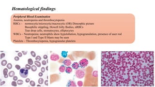 APPROACH TO DIAGNOSIS OF PANCYTOPENIA.pptx