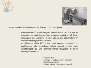 TOMOGRAFIA AD EMISSIONE DI SINGOLO FOTONE (SPECT) 
Come nella PET, anche in questa tecnica si fa uso di sostanze 
marcate con radioisotopi che vengono iniettate nel flusso 
sanguigno del paziente e che vanno ad accumularsi in 
determinate regioni del cervello. 
A differenza della PET, i traccianti vengono marcati con 
radioisotopi che emettono fotoni singoli e che sono 
caratterizzati da una emivita molto maggiore di quelli 
impiegati nella PET. 
flusso ematico 
patologie neurodegenerative e tumorali 
alterazioni funzionali 
Indicata solo per ristrette aree cerebrali 
PATTERN NEUROFUNZIONALI E BRAIN IMAGING 
NEI DISTURBI DELLO SPETTRO AFFETTIVO 
 