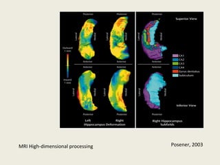 MRI High-dimensional processing Posener, 2003 
 
