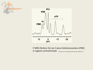 PATTERN NEUROFUNZIONALI E BRAIN IMAGING 
NEI DISTURBI DELLO SPETTRO AFFETTIVO 
P-MRS (fosforo 31) con il picco fosfomonoestere (PME) 
in regione corticofrontale Da Kato et al., J Neuropsychiatry Clin Neurosci 1998 10: 133 
 