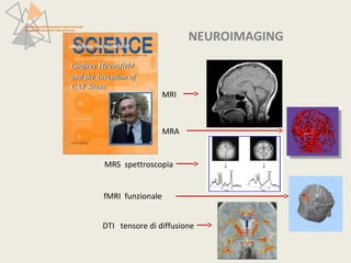 NEUROIMAGING 
MRI 
MRA 
MRS spettroscopia 
fMRI funzionale 
DTI tensore di diffusione 
PATTERN NEUROFUNZIONALI E BRAIN IMAGING 
NEI DISTURBI DELLO SPETTRO AFFETTIVO 
 
