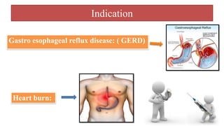 Indication
Gastro esophageal reflux disease: ( GERD)
Heart burn:
 