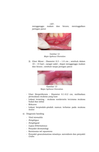 Panduan praktik klinik bagi dokter gigi dari pb pdgi