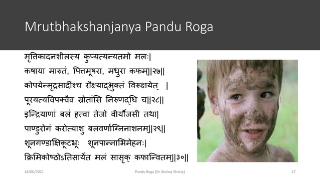 Pandu Roga | PPTX | Hinduism | Religion & Spirituality
