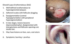 Comprehensive Case-Based Discussion on Cicatricial Alopecia Diagnosis ...