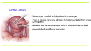 Serosal Closure
• Serous layer baseball technique invert the raw edges
• There is no data it prevents adhesion formation and better than simple
running stitch
• Barbed suture for serosa- excess barb on serosal surface avoided
• Associated with post bowel obstruction
 